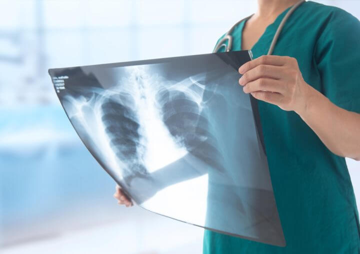 Personal Injury X-Ray
